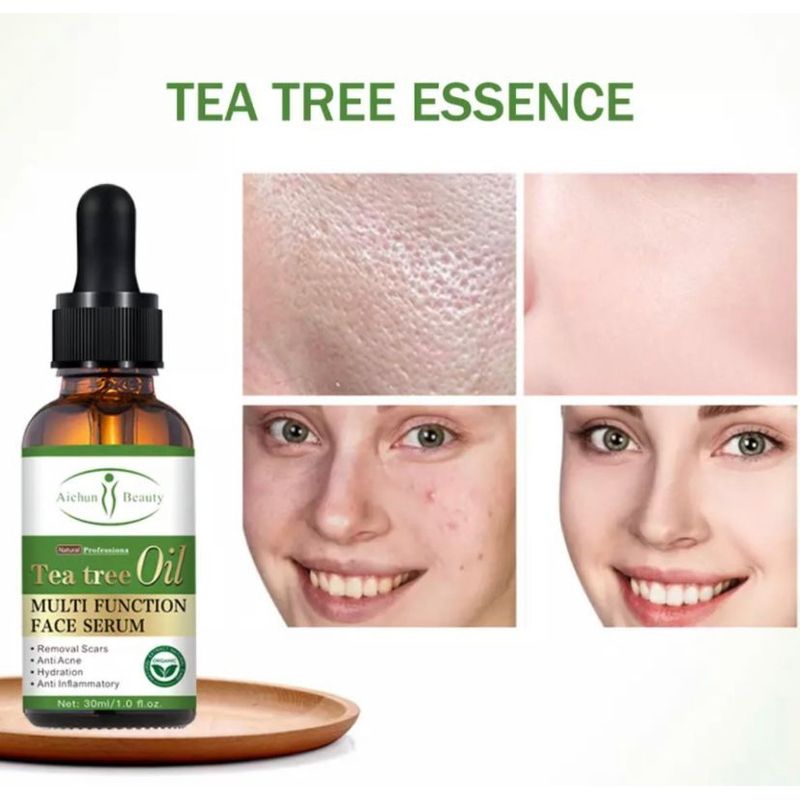 GENERICO - Serum Facial Té Verde Anti Acné Remueve Manchas 30ml.