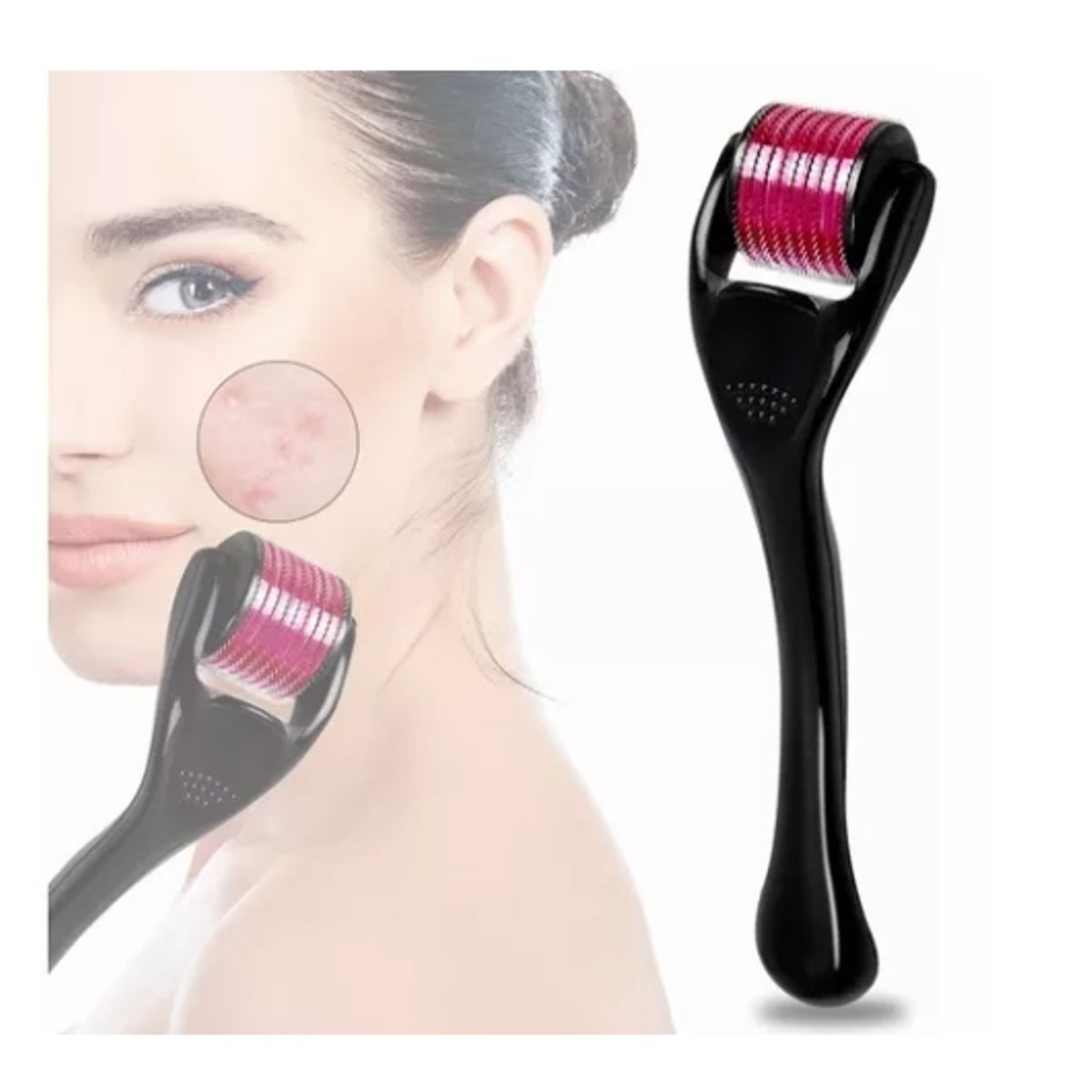 GENERICO - Derma Roller Rodillo Estimulador Crecimiento 10mm