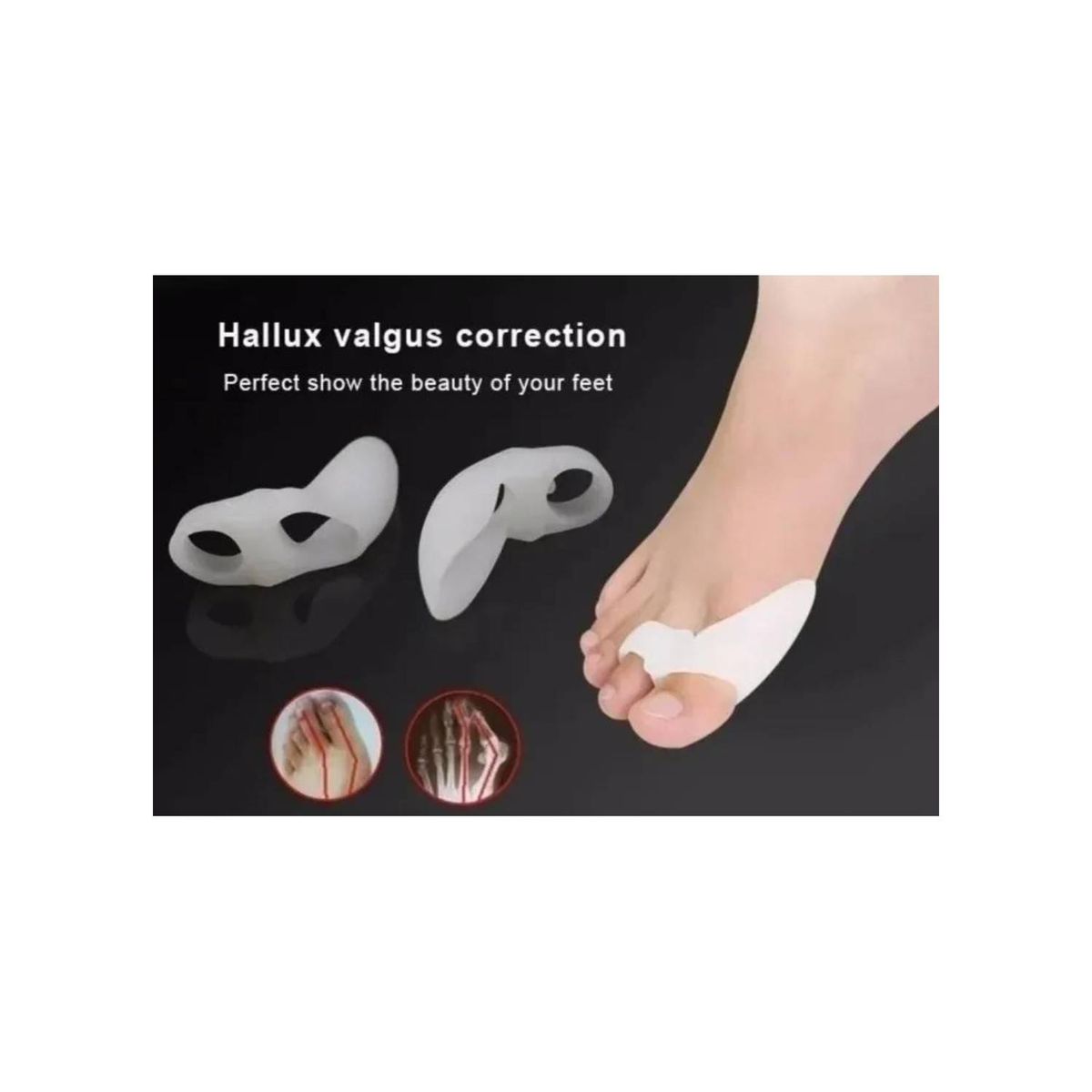 GENERICO - Corrector Y Protector De Juanete Silicona Separador Dedo Pie