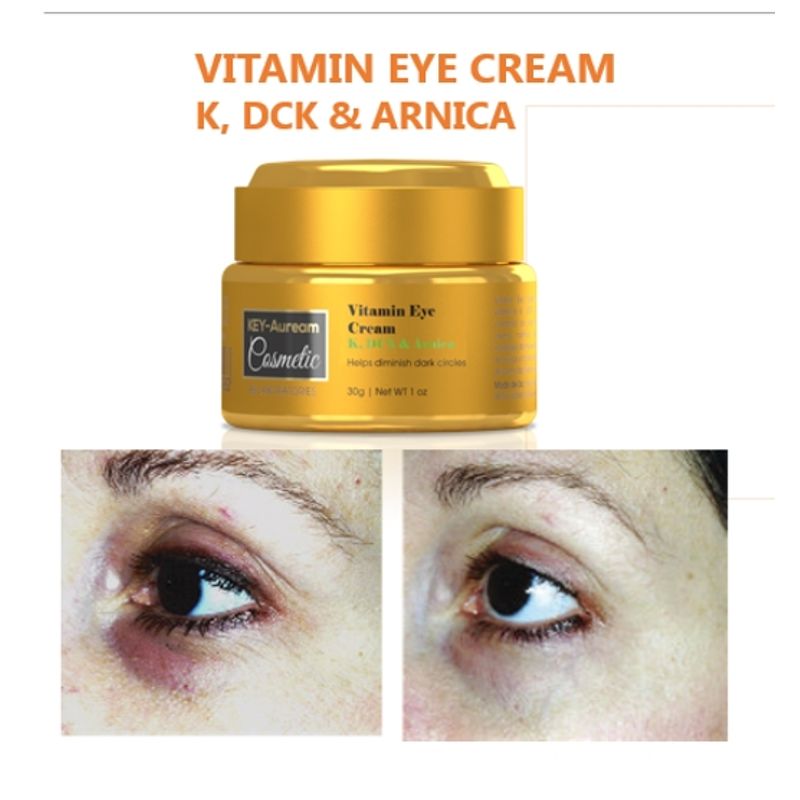 GENERICO - Vitamina para Bolsas en  Ojos cream con K DCK  Arnica.