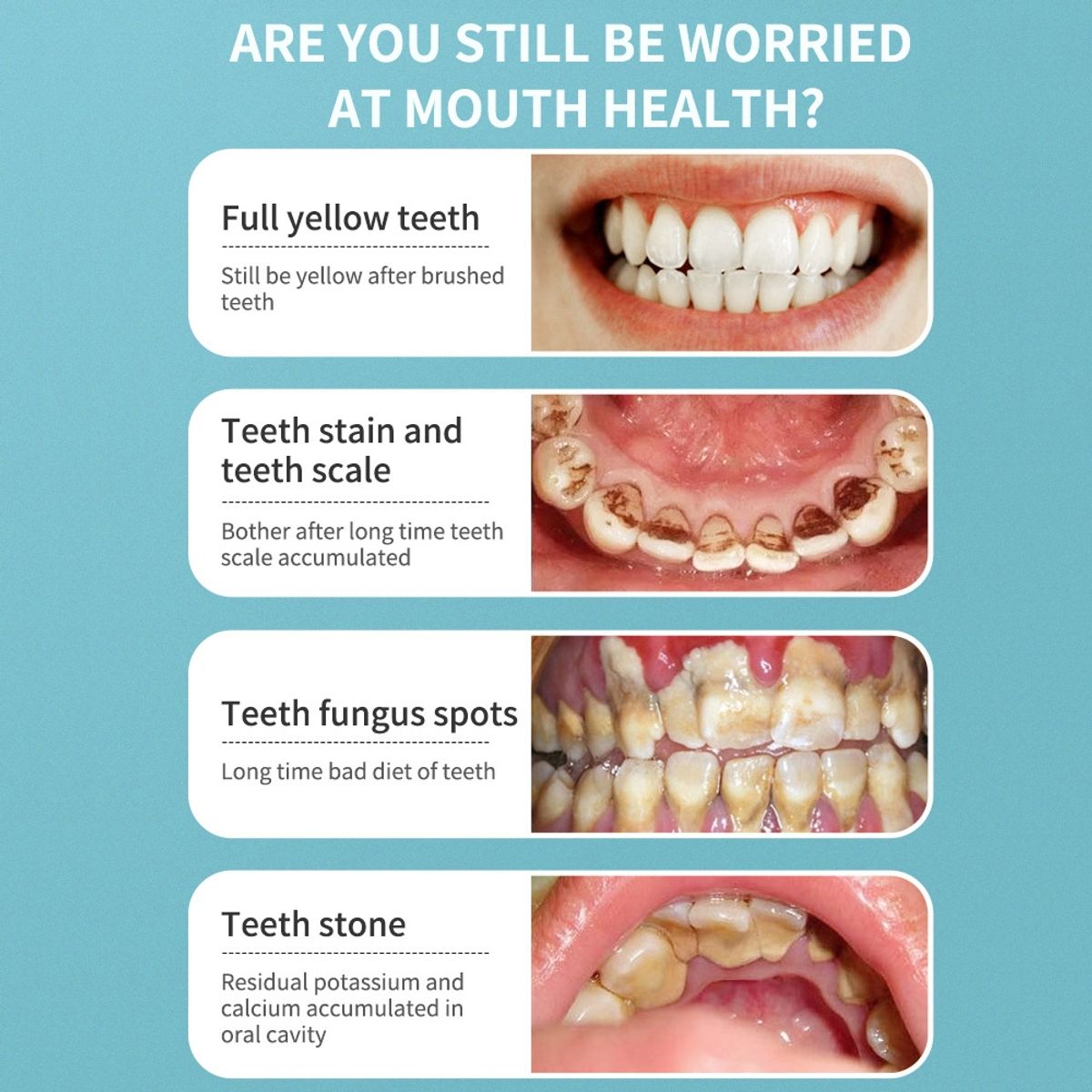 KUANGYE - cepillo de dientes limpiador removedor de sarro raspador