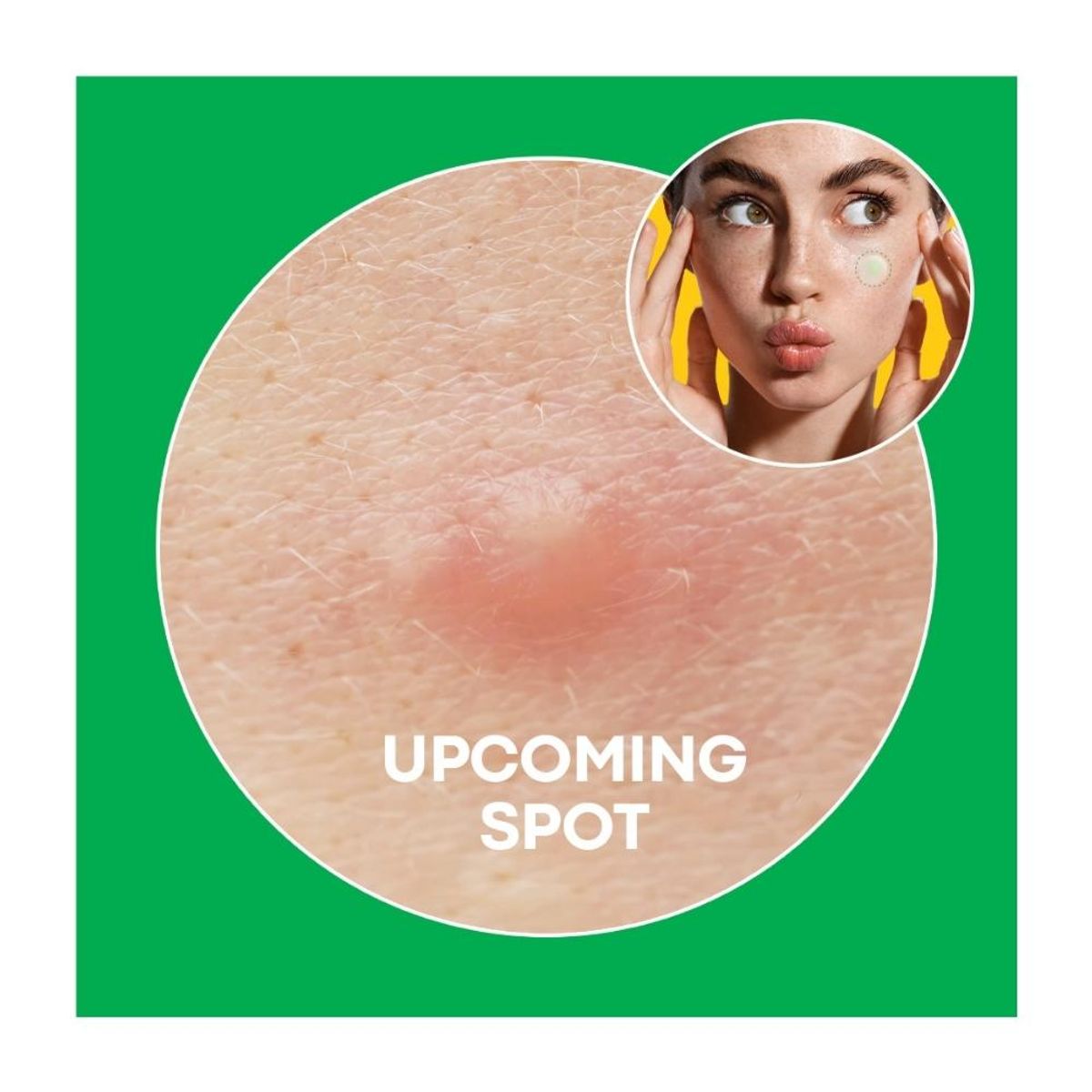 NOLAHOUR - Parches Antiacné - Cosméticos Coreanos