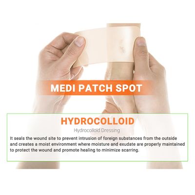 Imagen 2 del producto Parches Anti Acné Tratamiento Para Granitos- Cosmética Coreana