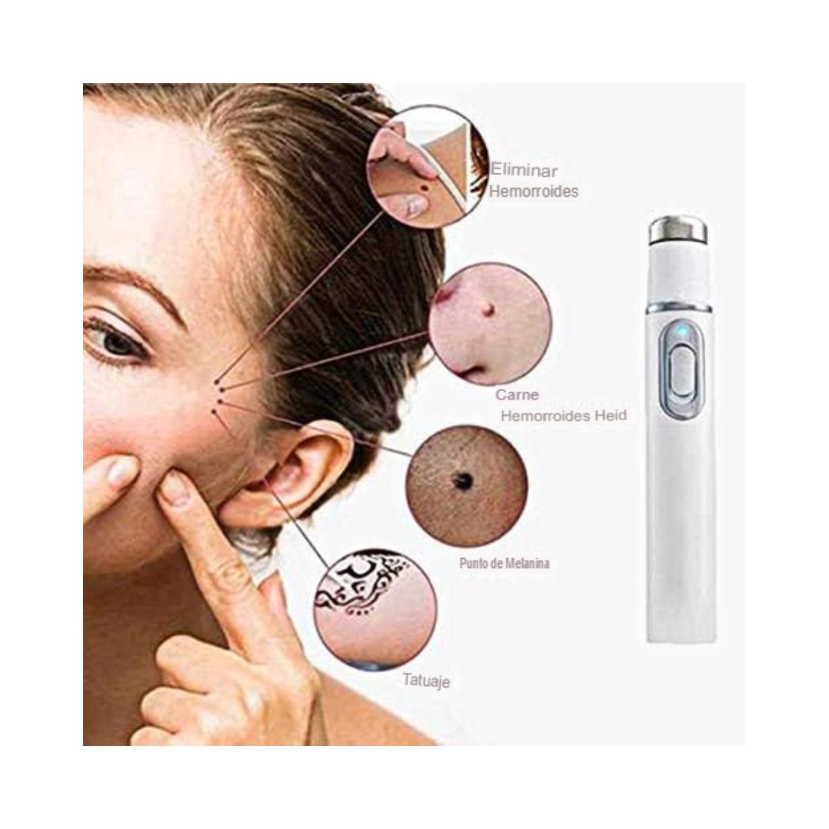 GENERICO - Maquina para extracción de Acné y tratamiento de piel