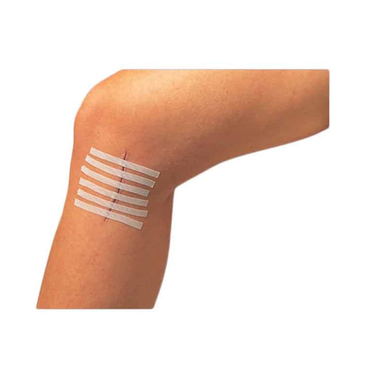 RECOVERY - PACK 2 SUTURAS ADHESIVAS 6mm X 75mm CIERRE DE HERIDAS RECOVERY