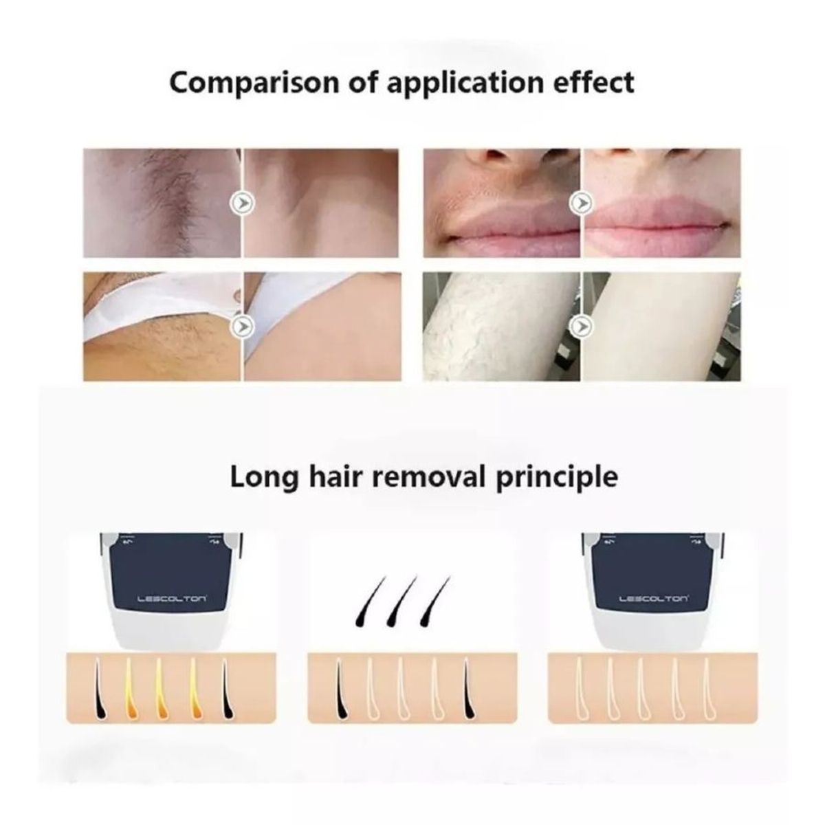 GENERICO - DEPILADORA IPL MAQUINA DEPILADORA DEFINITIVA LASER