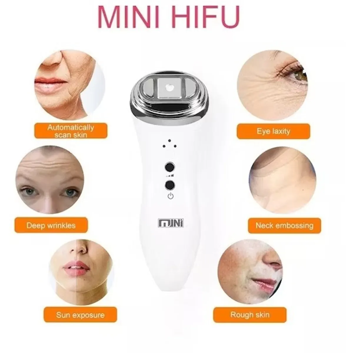 GENERICO - Maquina De Rejuvenecimiento Facial Ultrasónico Rf Mini Hifu Portátil