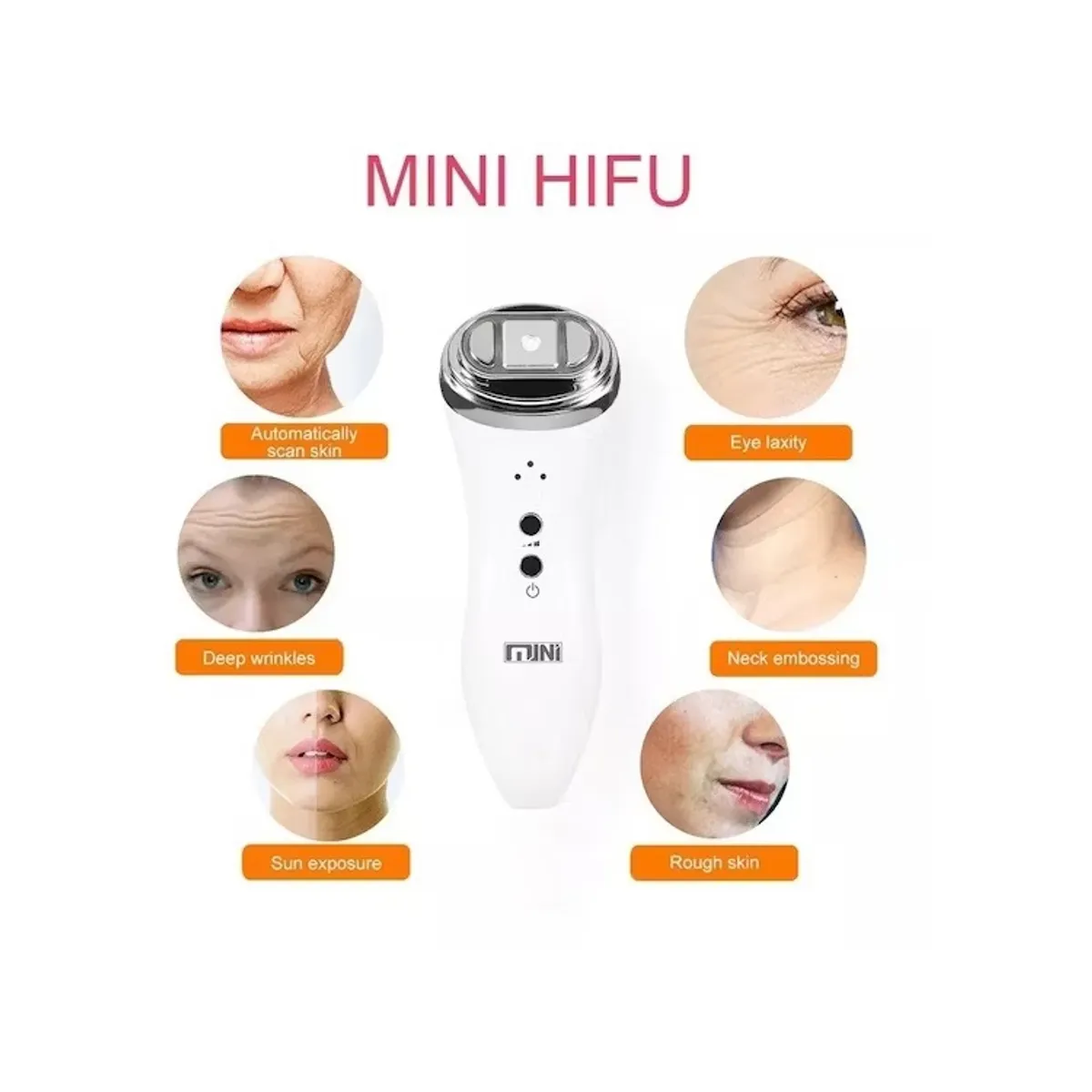 GENERICO - Maquina De Rejuvenecimiento Facial Ultrasónico Rf Mini Hifu Portátil