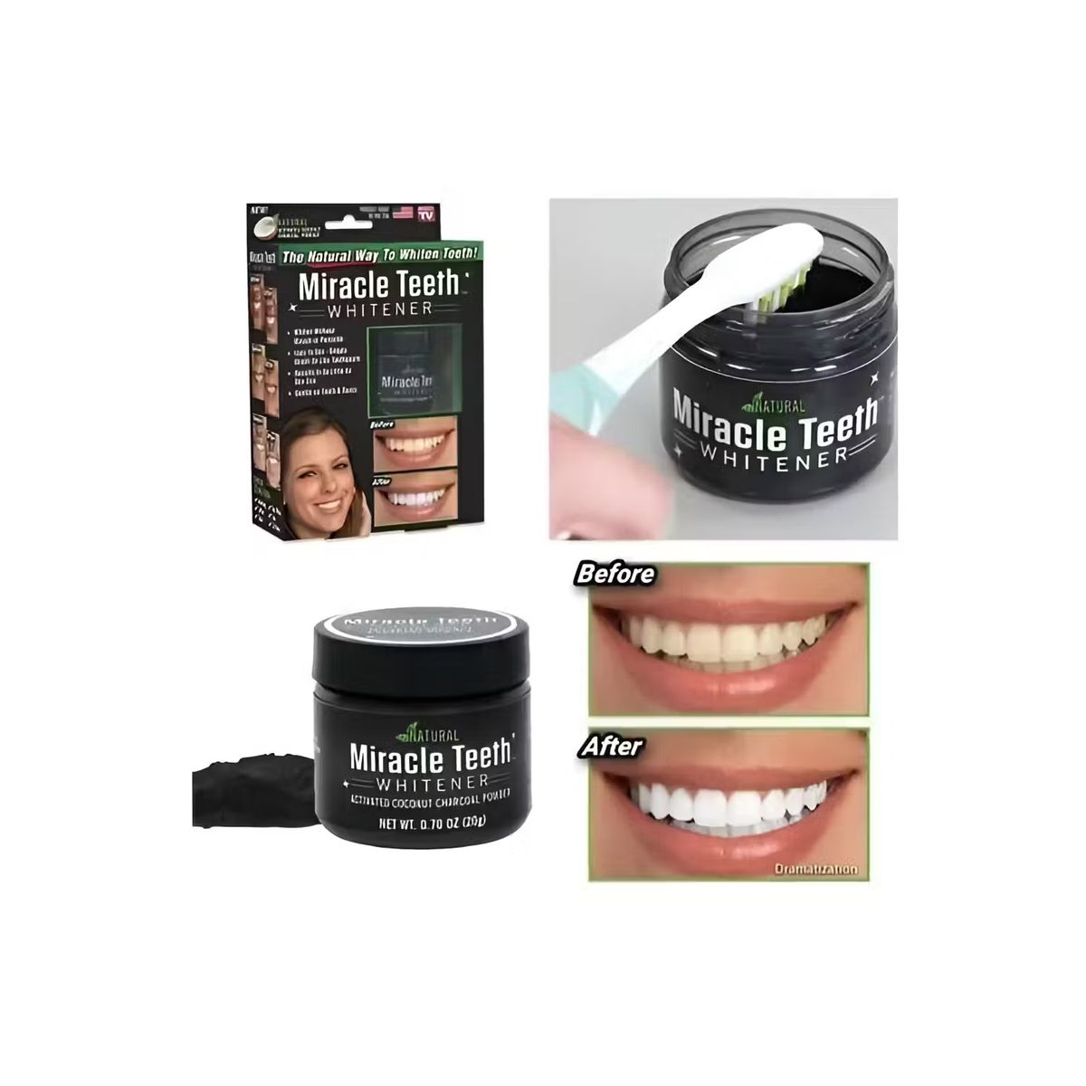 GENERICO - Blanqueador De Dientes Teeth Whitening Miracle Teeth