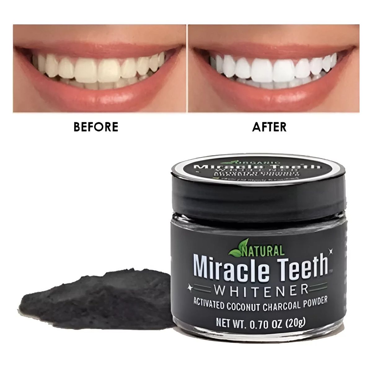 GENERICO - Blanqueador De Dientes Teeth Whitening Miracle Teeth