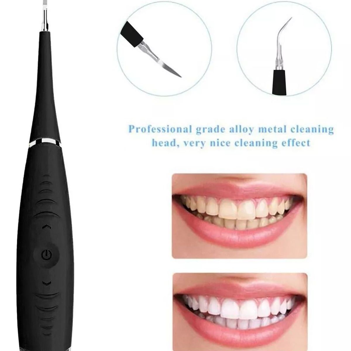 KUANGYE - Herramientas De Limpieza Dientesremovedor De Placa Y Sarro