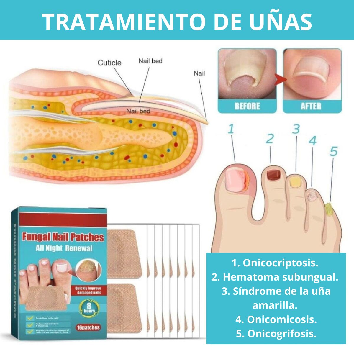 GENERICO - Parches Nocturnos Para Tratamiento Hongos De Uñas Onicomicosis