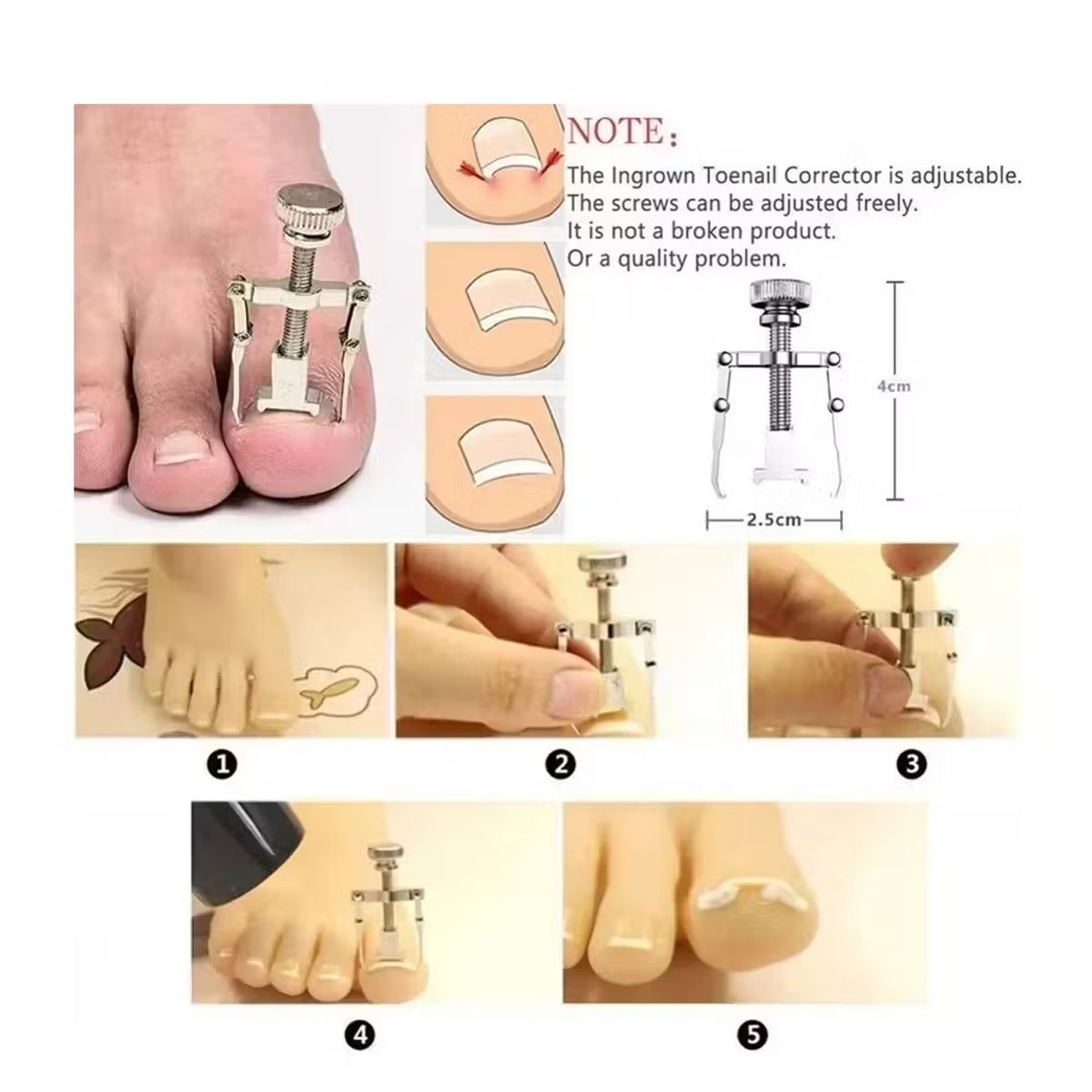 GENERICO - Set De Pedicura Herramientas Para Uñas Encarnadas