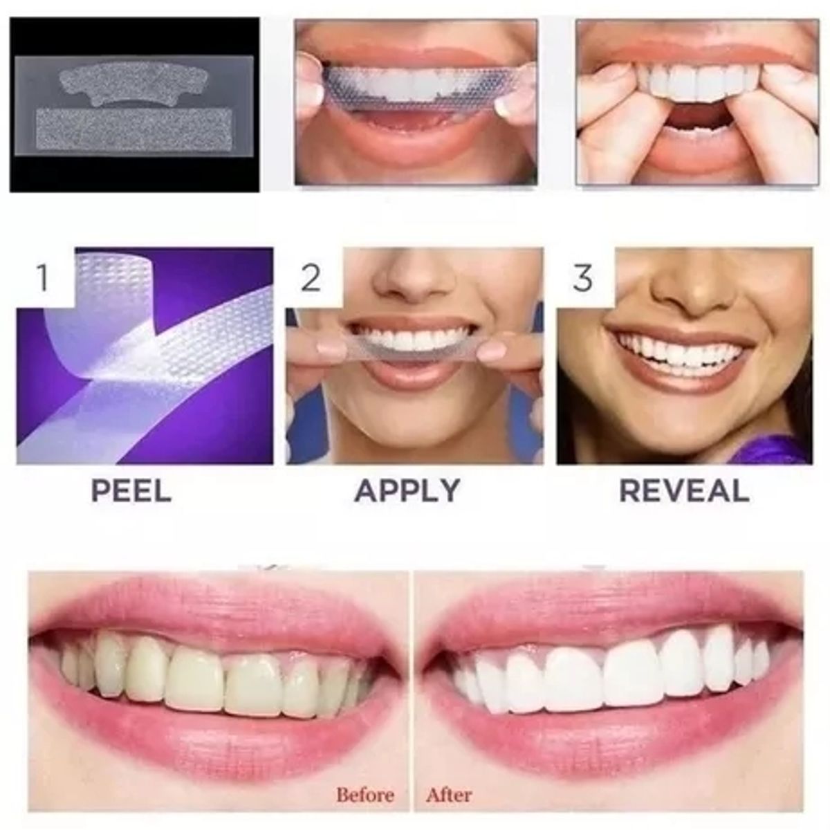 GENERICO - Tiras Blanqueamiento Dental 5d Advanced teed 2 Cajas.