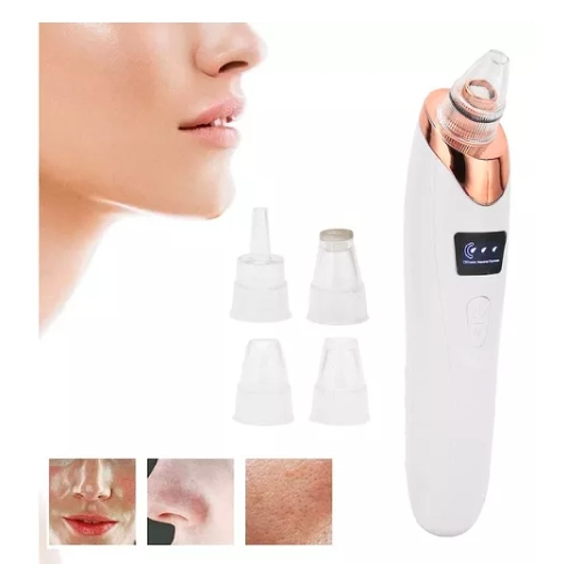 GENERICO - Extractor Puntos Negros Removedor Limpiador Facial Electrico.