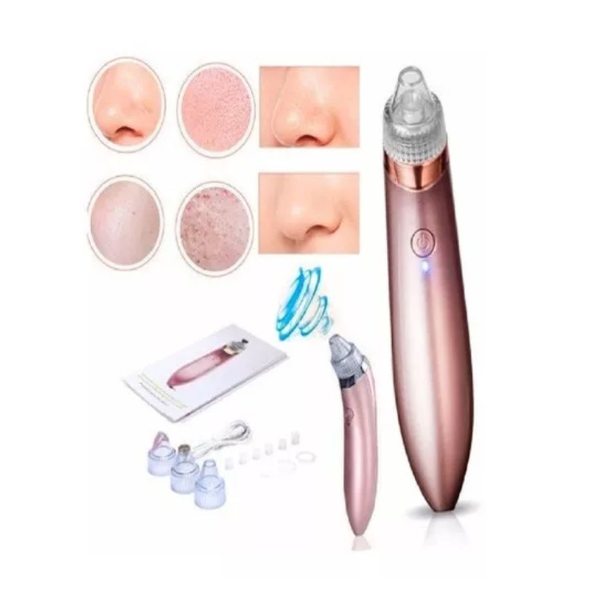 GENERICO - Removedor Extractor De Puntos Negros Limpieza Facial