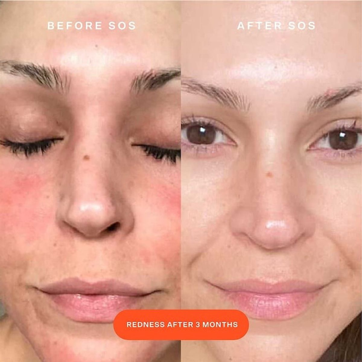 TOWER 28 BEAUTY - Mini Spray Facial Rescate Diario SOS 30ml Tower 28.-