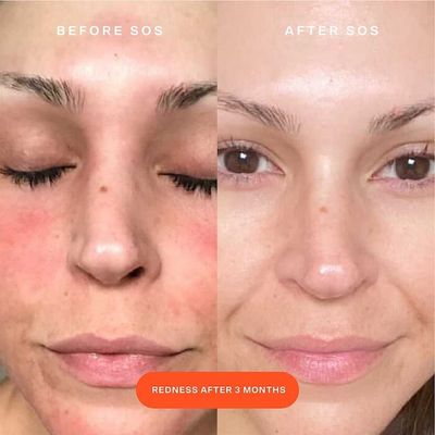 Imagen 2 del producto Mini Spray Facial Rescate Diario SOS 30ml Tower 28.-