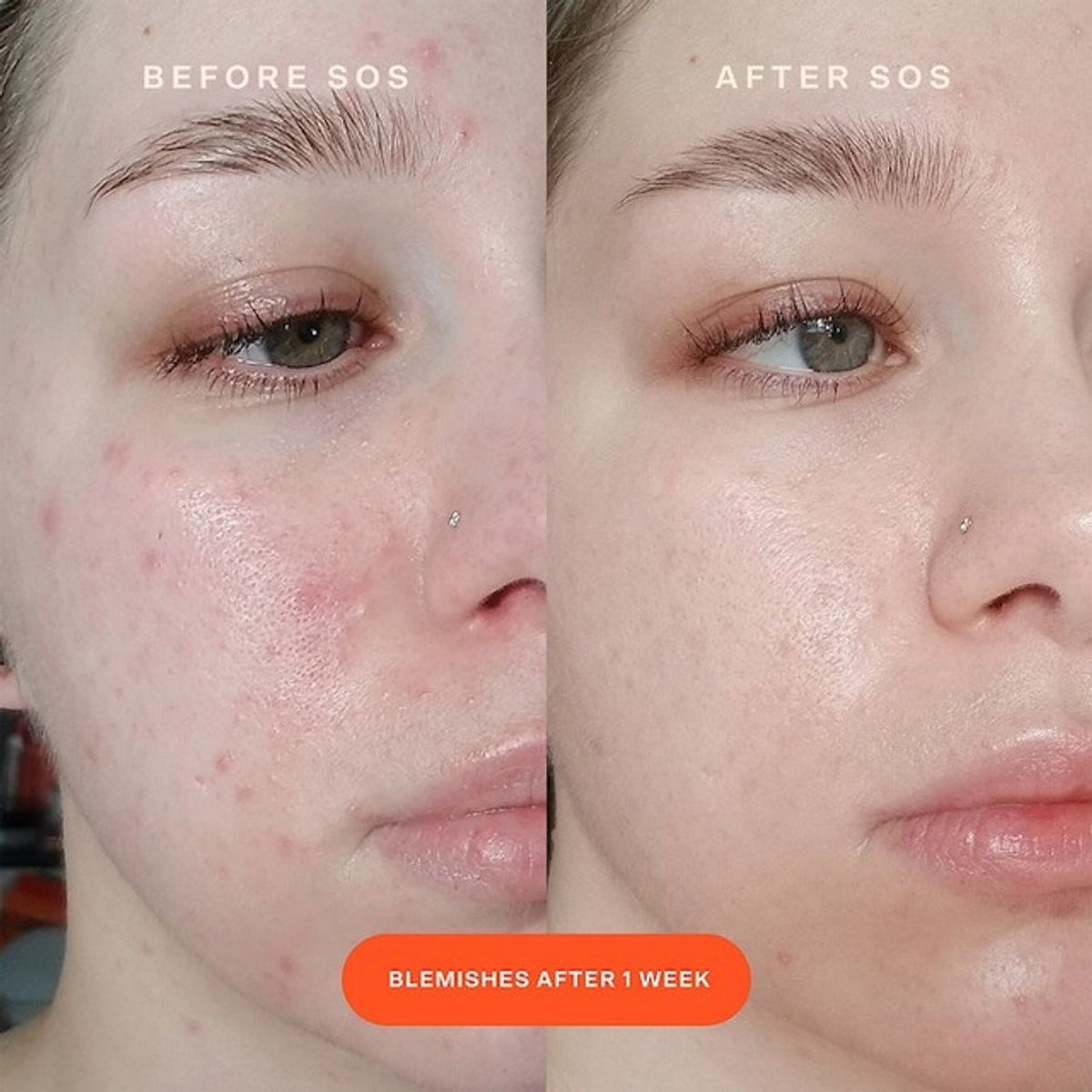 TOWER 28 BEAUTY - Suero para Aliviar las Rojeces SOS 59.2ml Tower 28.-