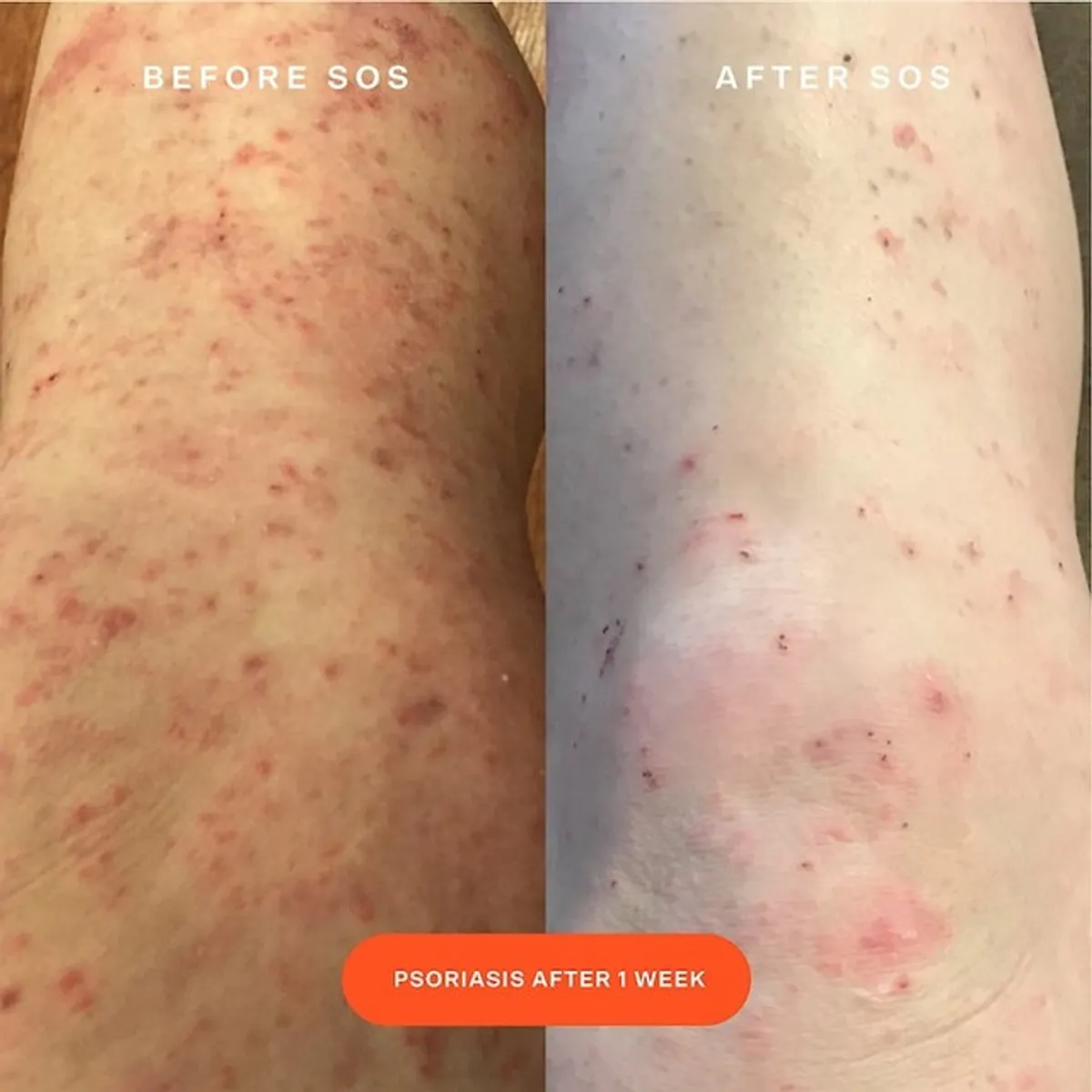 TOWER 28 BEAUTY - Spray Facial Rescate Diario SOS 120ml Tower 28