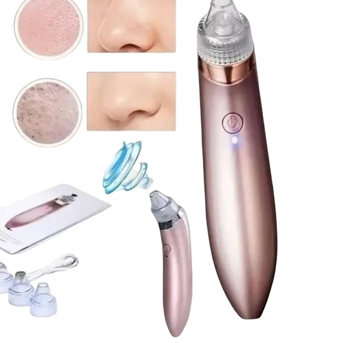 OEM - Removedor Extractor Puntos Negros Espinillas Y Limpia Poros.