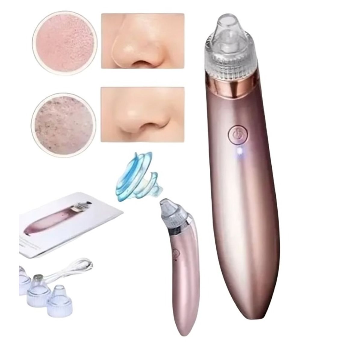 OEM - Removedor Extractor Puntos Negros Espinillas Y Limpia Poros.