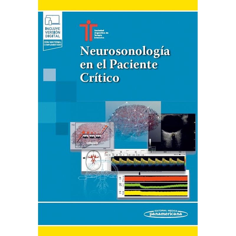 EDITORIAL MEDITERRANEO - Libro Neurosonologia En Paciente Critico