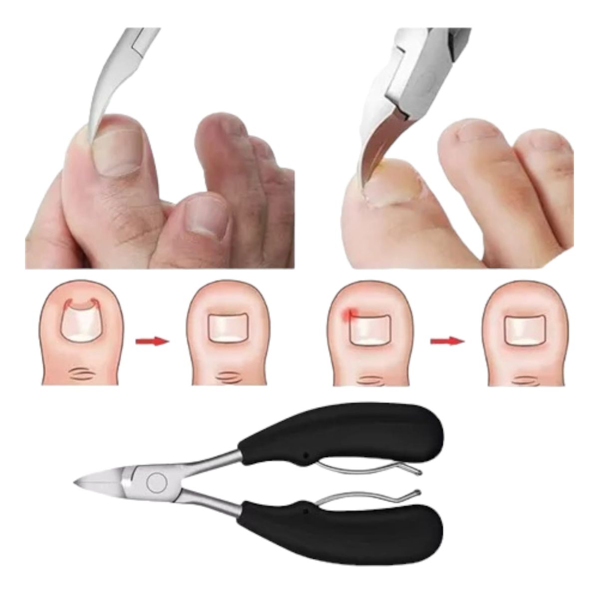 GENERICO - Cortauñas Dedo Del Pie Uñas Encarnadas O Gruesas