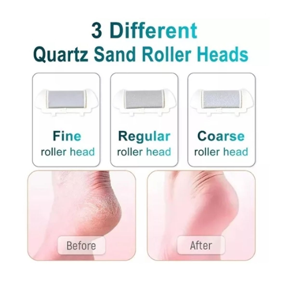 GENERICO - Lima Para Pies Eléctrico Removedor De Cayos Y Durezas