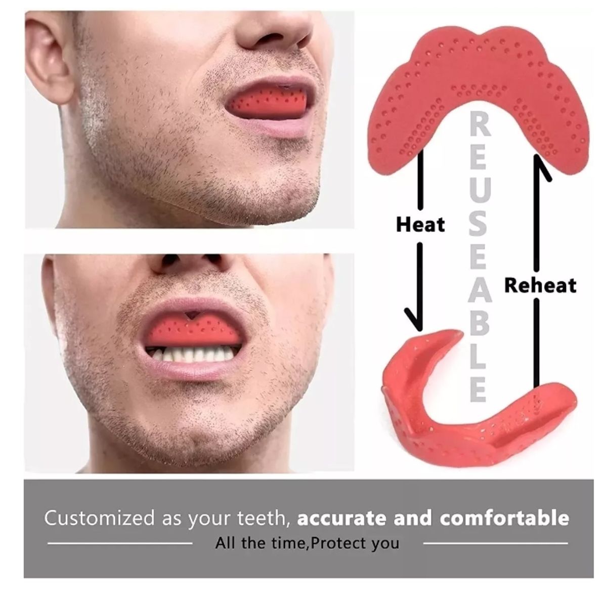 GENERICO - Protector Bucal Flat Aero +10 Años