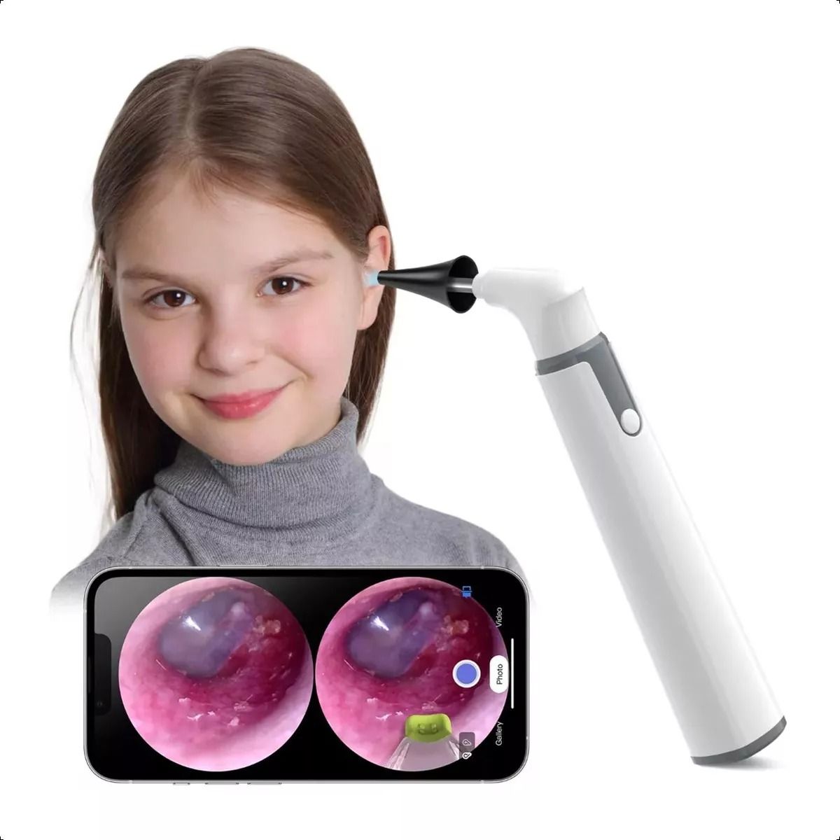 GENERICO - Otoscopio Inalámbrico Wifi Con Cámara De Oído Luz Led