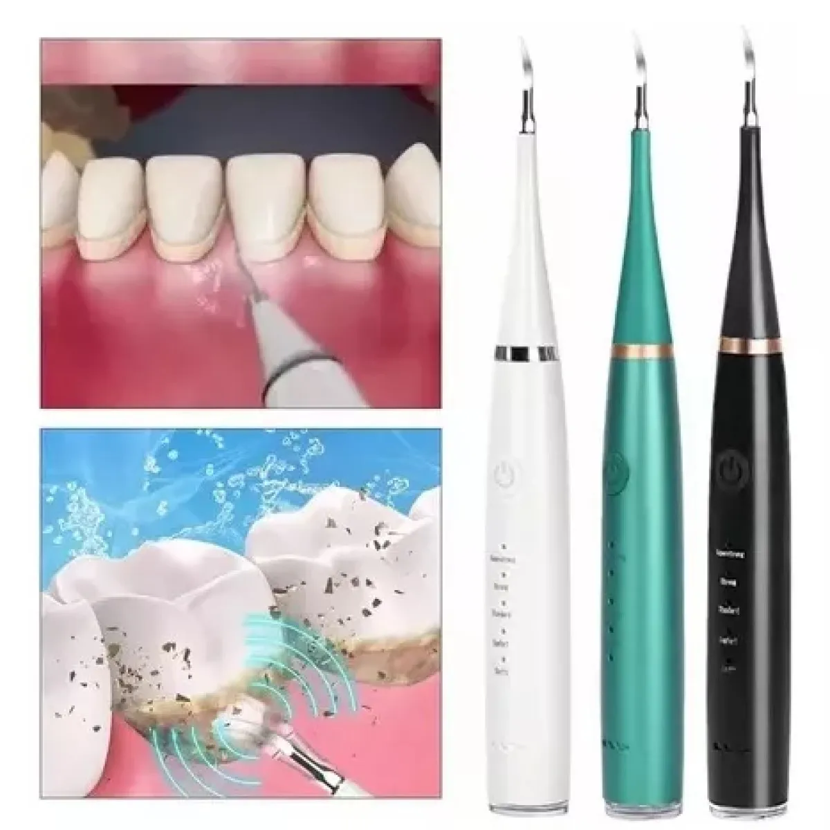 MUNDO MAGIA - Kit Limpiador Dental Eléctrico Ultrasónico Removedor Cálculo