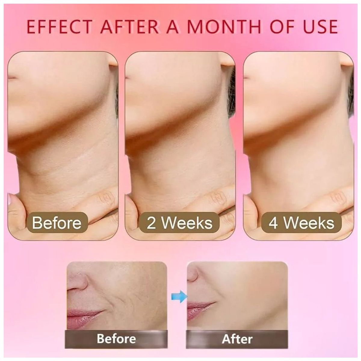 KUANGYE - Masajeador Reductor De Papada Antiarruga Para Mejilla Cuello