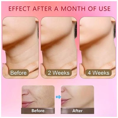 Imagen 2 del producto Masajeador Reductor De Papada Antiarruga Para Mejilla Cuello