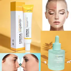 MAX BELLE - Crema Facial Anti Acné Espinillas Reparador+serum Acido Salicilico