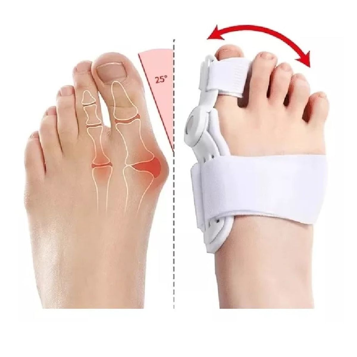 GENERICO - Separador Corrector Juanetes Pie Blanco Almohadilla Premium