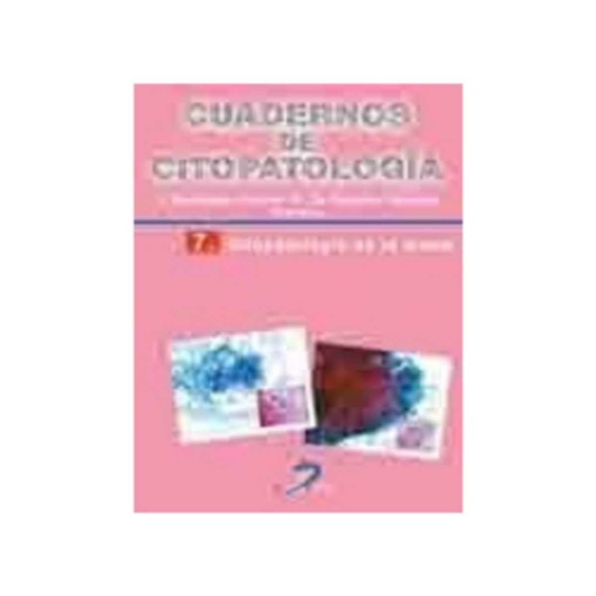 ANTARTICA LIBROS - Citopatologia De La Mama