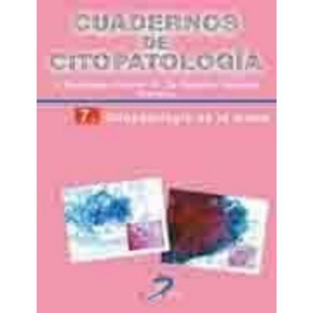 ANTARTICA LIBROS - Citopatologia De La Mama