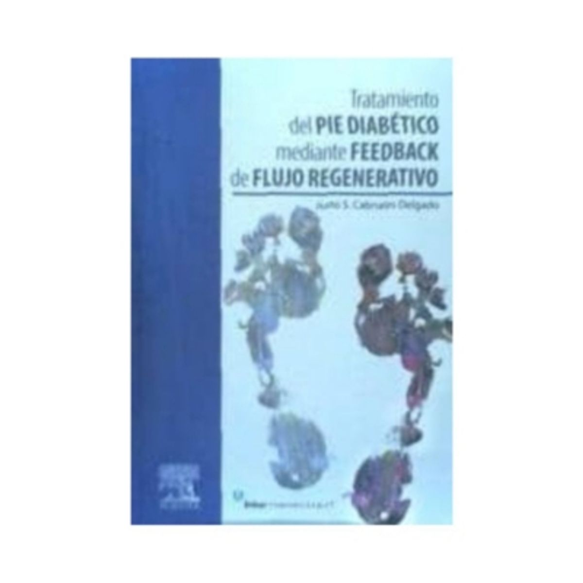 ELSEVIER - Tratamiento Del Pie Diabetico Mediante Feedback De Flujo Regenerativo