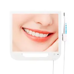 GENERICO - Cámara Dental Intraoral Inalámbrica con Monitor de 17 Pulgadas con Wifi RIXI