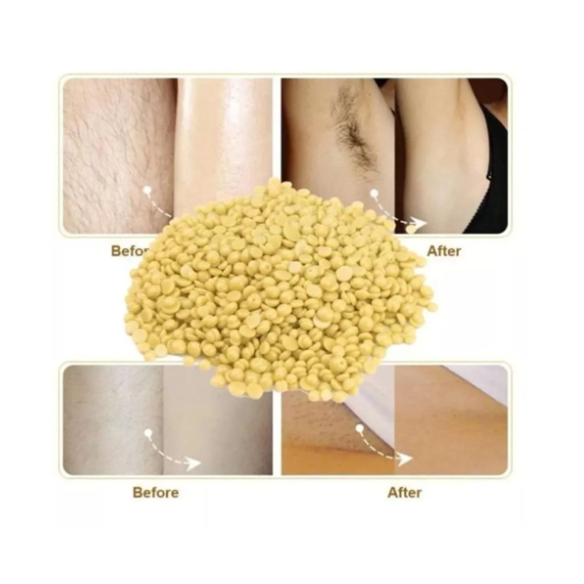 GENERICO - Pack Cera Elástica De 300 Gramos Más Olla De Depilación