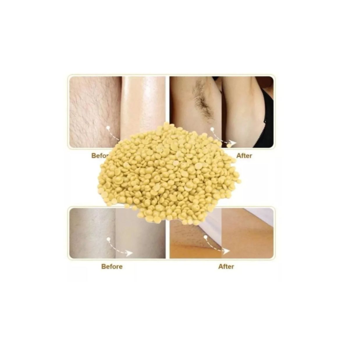 GENERICO - Pack Cera Elástica De 300 Gramos Más Olla De Depilación