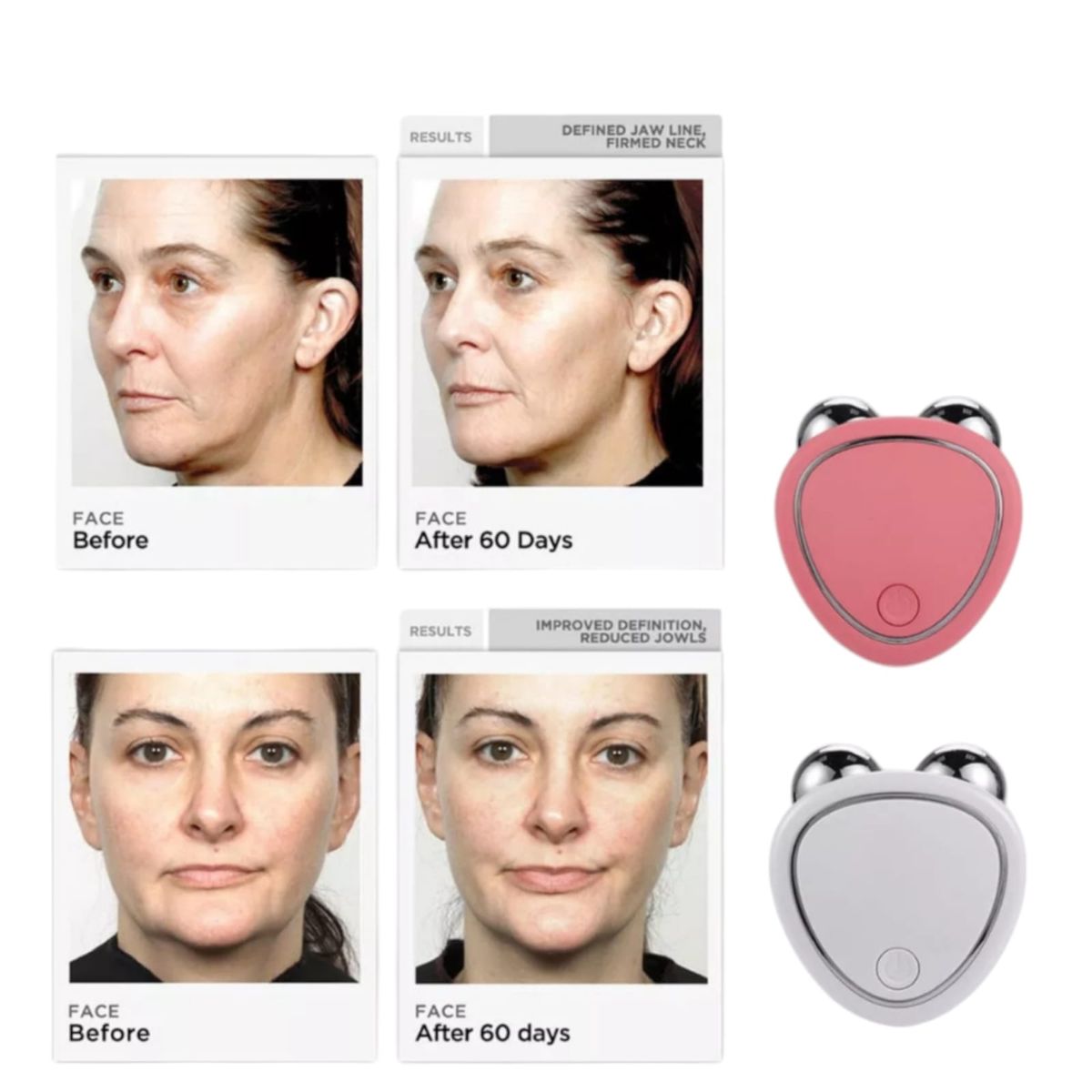 GENERICO - Rodillo Facial Microcorriente Rejuvenecimiento V