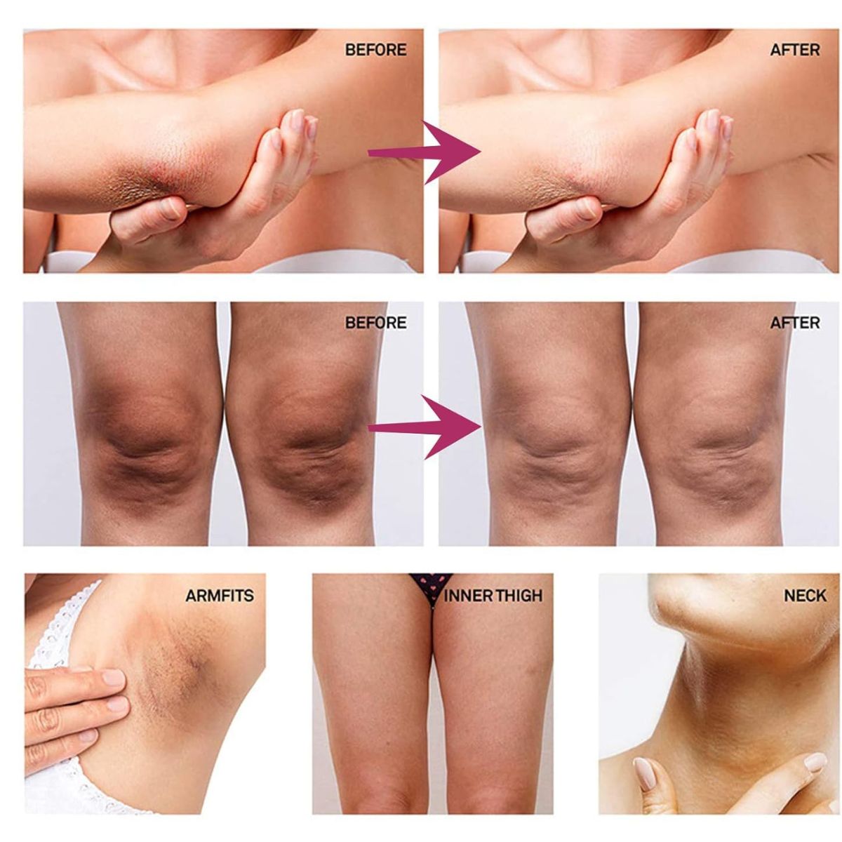 GENERICO - Crema Blanqueadora y Jabón Blanqueador