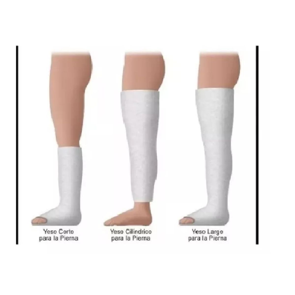 GENERICO - Venda De Yeso 20cm X 3mt Lesiones Yesoterapia Manualidades