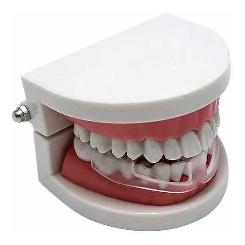 GENERICO - Pack de 5 Placas de Bruxismo Dental para Protección Nocturna