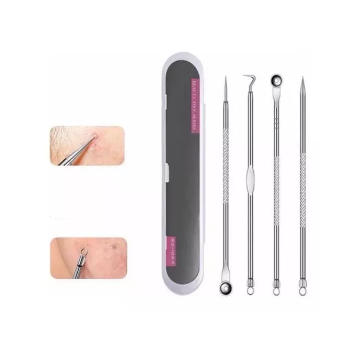 GENERICO - 12 X Kit Extractores Puntos Negros