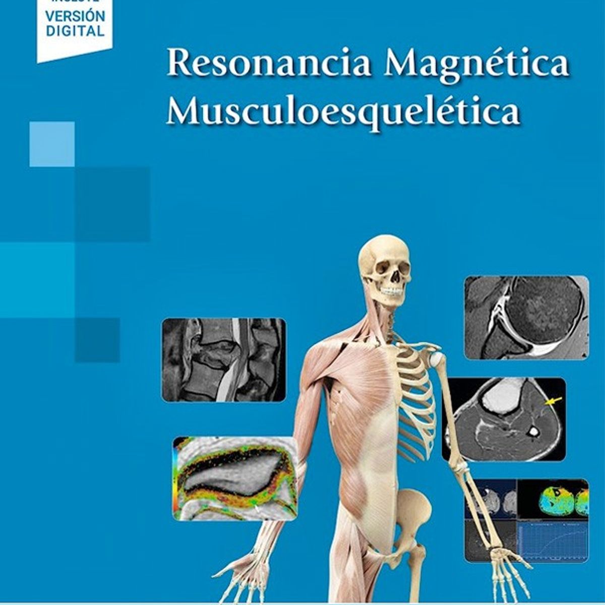 EDITORIAL MEDITERRANEO - Libro Resonancia Magnetica Muscoloesqueletica