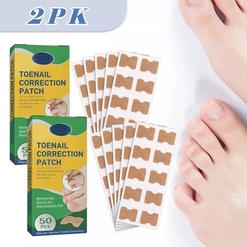 KUANGYE - 100 Parches Correctores De Uña Encarnados