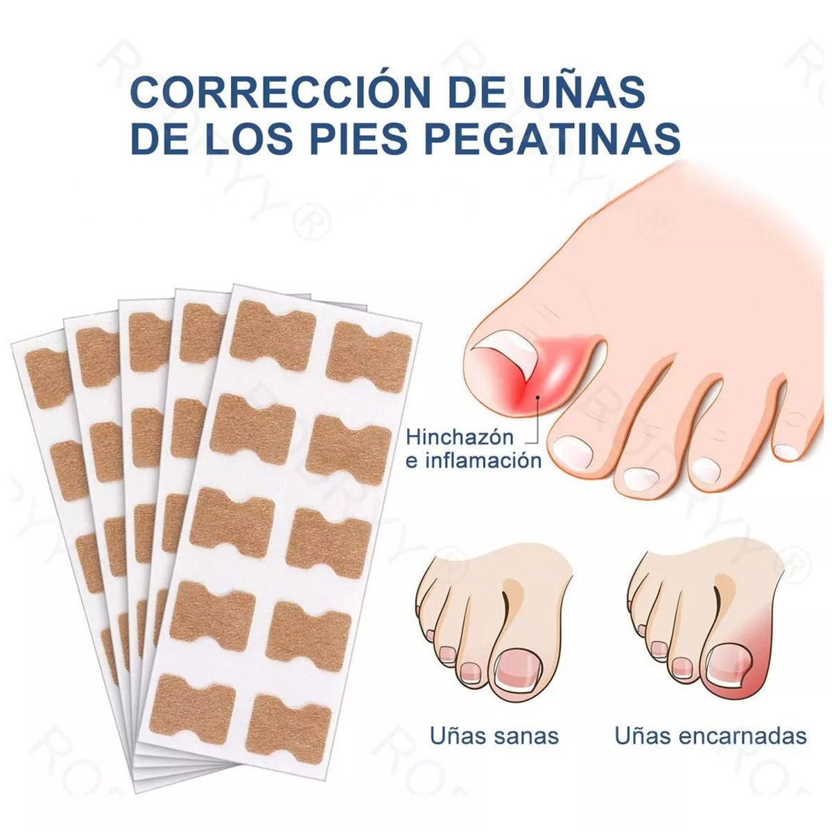 KUANGYE - 100 Parches Correctores De Uña Encarnados